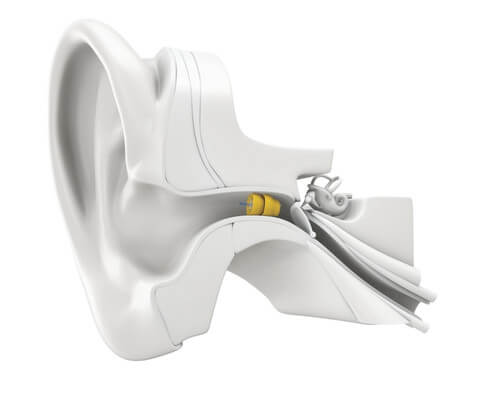 Illustration showing a hearing device positioned inside the ear canal